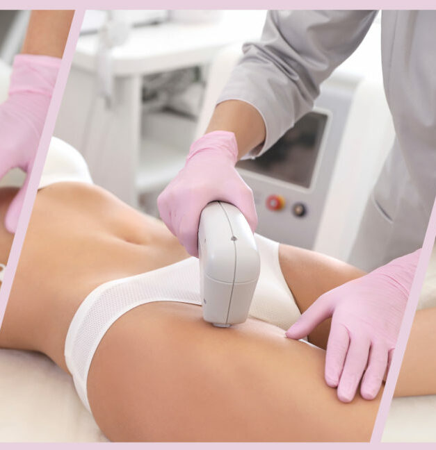 Epilation Définitive sur Saint Chamond