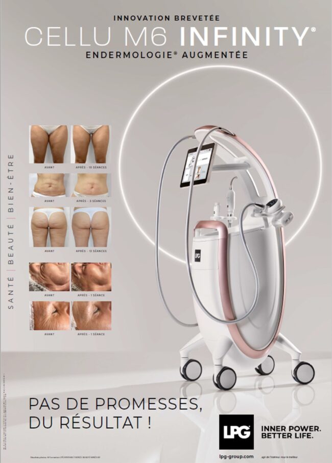 resultats-lpg-infinity